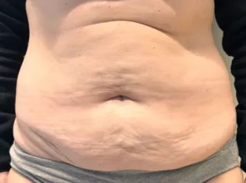 SSJ Abdo Before