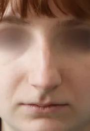 TJ Before Rhinoplasty Front