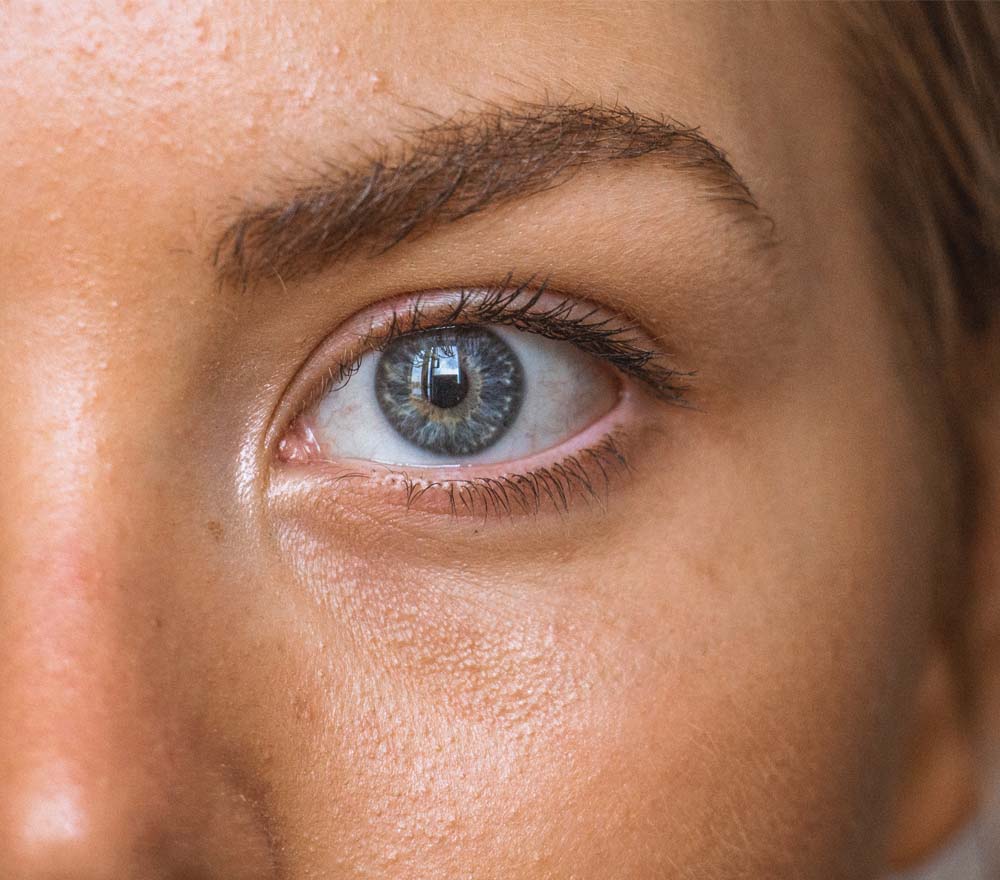What is Hooded Eye?