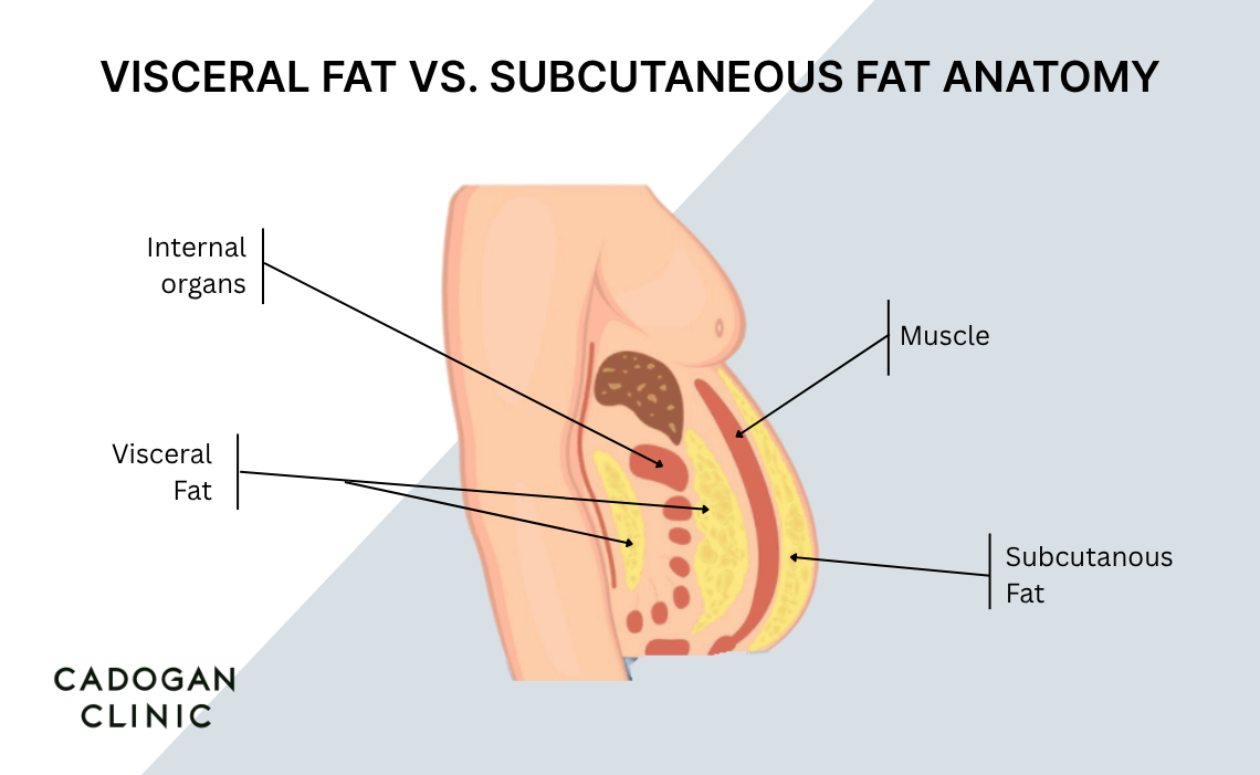 A diagram showing the placement of visceral and subcutaneous fat within the abdomen