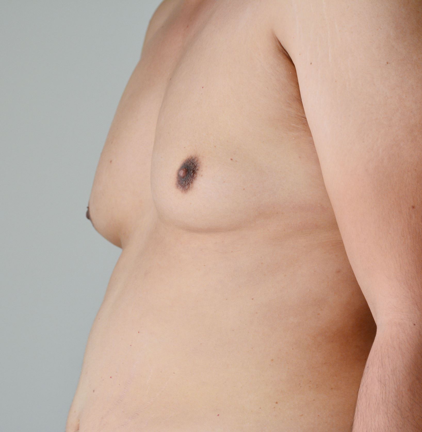 Bra Size Chart • Male Breast Enlargement